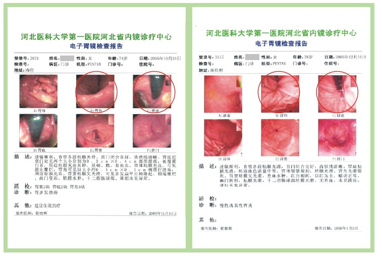 加拿大pc28预测(中国区)官方网站