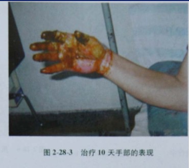 201133134422841